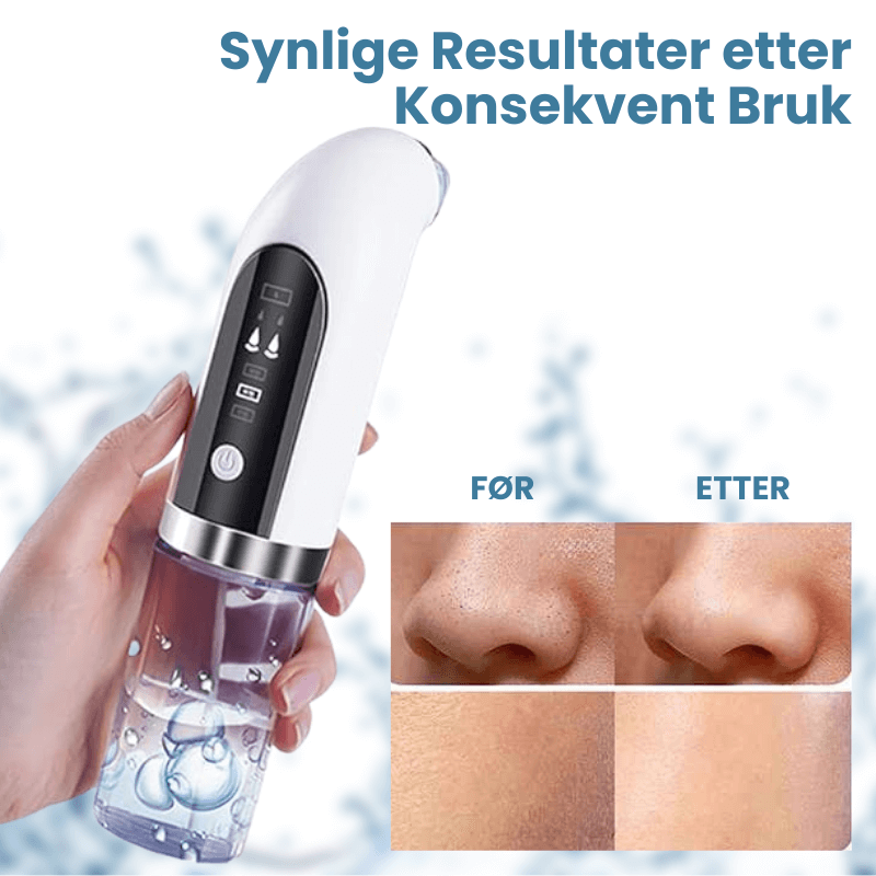 ClearSkin Pro™ - Dyp Rens, Strålende Glød