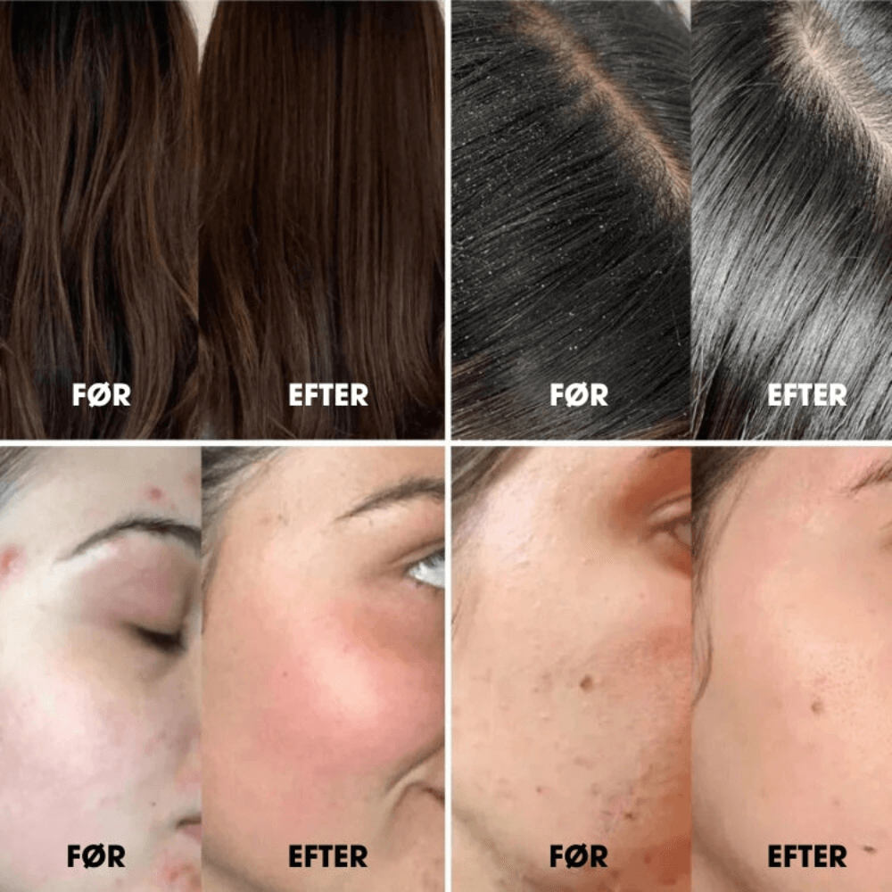 HydraLux™ - Premium vannbesparende dusjhode + 5 Gratis Filtre