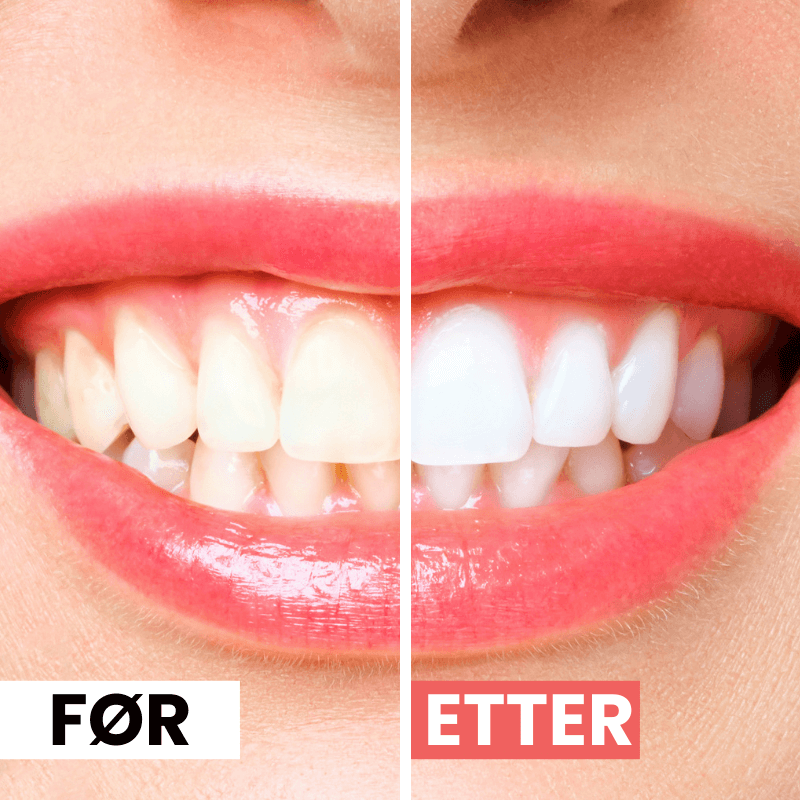 PureSmile™ -Elektrisk Rengjøringsbørste