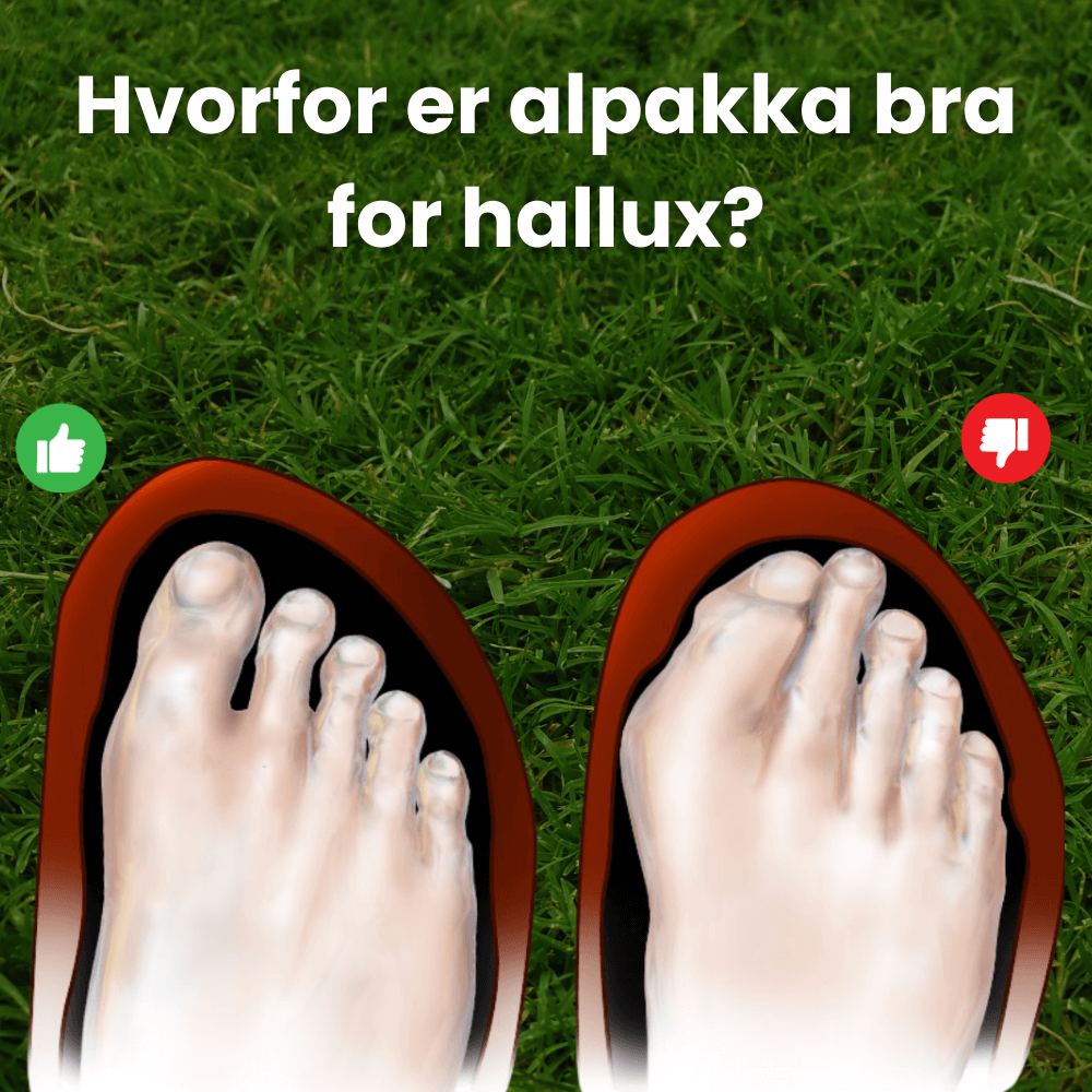 PureStep™ – Støttesko for Hallux